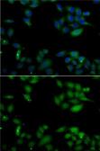 Anti-HIP1 antibody used in Immunocytochemistry/ Immunofluorescence (ICC/IF). GTX32653