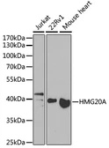 Anti-HMG20A antibody used in Western Blot (WB). GTX32655