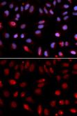 Anti-HUS1 antibody used in Immunocytochemistry/ Immunofluorescence (ICC/IF). GTX32662