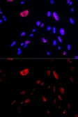 Anti-HUS1 antibody used in Immunocytochemistry/ Immunofluorescence (ICC/IF). GTX32662