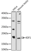 Anti-IGF1 antibody used in Western Blot (WB). GTX32670