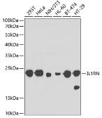 Anti-IL1 Receptor antagonist antibody used in Western Blot (WB). GTX32673