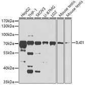 Anti-IL4I1 antibody used in Western Blot (WB). GTX32678