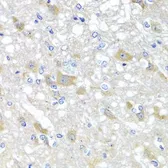 Anti-SKIP antibody used in IHC (Paraffin sections) (IHC-P). GTX32681