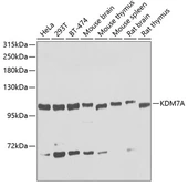 Anti-JHDM1D antibody used in Western Blot (WB). GTX32688