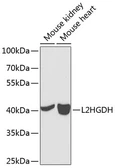 Anti-L2HGDH antibody used in Western Blot (WB). GTX32695