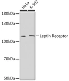 Anti-Leptin Receptor antibody used in Western Blot (WB). GTX32703