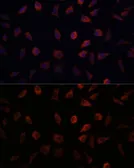 Anti-L-FABP antibody used in Immunocytochemistry/ Immunofluorescence (ICC/IF). GTX32704
