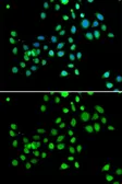Anti-Macro H2A.1 antibody used in Immunocytochemistry/ Immunofluorescence (ICC/IF). GTX32709