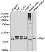 Anti-MAP2 antibody used in Western Blot (WB). GTX32712
