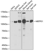 Anti-MBTPS1 antibody used in Western Blot (WB). GTX32714