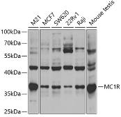 Anti-MC1 Receptor antibody used in Western Blot (WB). GTX32715