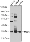 Anti-MED6 antibody used in Western Blot (WB). GTX32718