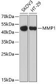 Anti-MMP1 antibody used in Western Blot (WB). GTX32723