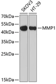 Anti-MMP1 antibody used in Western Blot (WB). GTX32723