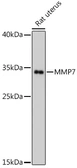 Anti-MMP7 antibody used in Western Blot (WB). GTX32725