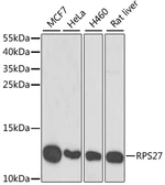 Anti-MPS1 antibody used in Western Blot (WB). GTX32727