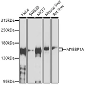 Anti-MYBBP1A antibody used in Western Blot (WB). GTX32732