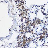 Anti-MYBBP1A antibody used in IHC (Paraffin sections) (IHC-P). GTX32732