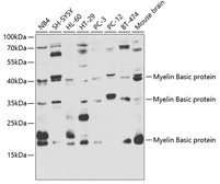 Anti-Myelin basic protein antibody used in Western Blot (WB). GTX32733