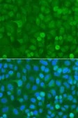 Anti-NCK1 antibody used in Immunocytochemistry/ Immunofluorescence (ICC/IF). GTX32738