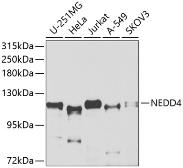 Anti-NEDD4 antibody used in Western Blot (WB). GTX32745