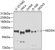 Anti-NEDD4 antibody used in Western Blot (WB). GTX32745
