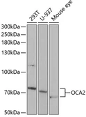 Anti-OCA2 antibody used in Western Blot (WB). GTX32764