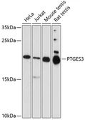 Anti-p23 antibody used in Western Blot (WB). GTX32771
