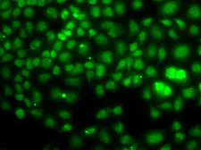 Anti-PCGF6 antibody used in Immunocytochemistry/ Immunofluorescence (ICC/IF). GTX32775