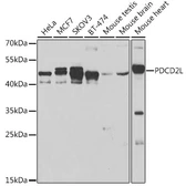 Anti-PDCD2L antibody used in Western Blot (WB). GTX32776