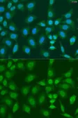 Anti-PHF21B antibody used in Immunocytochemistry/ Immunofluorescence (ICC/IF). GTX32789