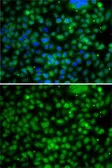 Anti-PHYHD1 antibody used in Immunocytochemistry/ Immunofluorescence (ICC/IF). GTX32791