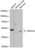 Anti-PNPLA3 antibody used in Western Blot (WB). GTX32794