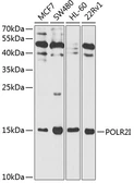 Anti-POLR2I antibody used in Western Blot (WB). GTX32797
