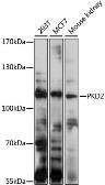 Anti-Polycystin 2 antibody used in Western Blot (WB). GTX32799