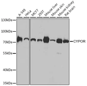 Anti-POR antibody used in Western Blot (WB). GTX32801