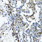Anti-PRMT5 antibody used in IHC (Paraffin sections) (IHC-P). GTX32810