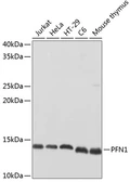 Anti-Profilin 1 antibody used in Western Blot (WB). GTX32811
