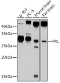Anti-Prolactin antibody used in Western Blot (WB). GTX32813