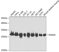 Anti-PSMA6 antibody used in Western Blot (WB). GTX32815