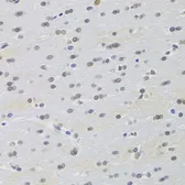 Anti-PRPF3 antibody used in IHC (Paraffin sections) (IHC-P). GTX32816