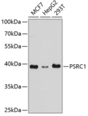 Anti-PSRC1 antibody used in Western Blot (WB). GTX32823