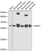 Anti-RAB23 antibody used in Western Blot (WB). GTX32826
