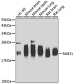 Anti-RAB31 antibody used in Western Blot (WB). GTX32827