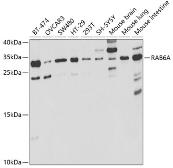 Anti-RAB6A antibody used in Western Blot (WB). GTX32829