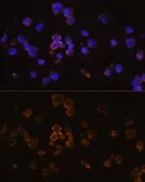Anti-RANKL antibody used in Immunocytochemistry/ Immunofluorescence (ICC/IF). GTX32834