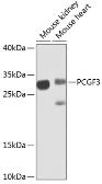 Anti-RNF3 antibody used in Western Blot (WB). GTX32842