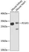 Anti-RNF3 antibody used in Western Blot (WB). GTX32842