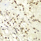 Anti-RPA32 antibody used in IHC (Paraffin sections) (IHC-P). GTX32844